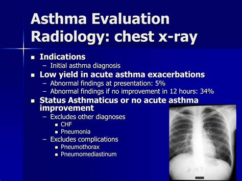 asthma x ray findings